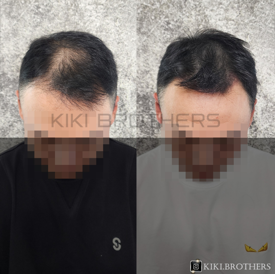 브라더스&비어 이미지
