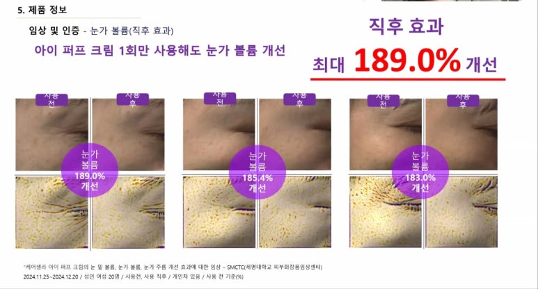 케어셀라 이미지