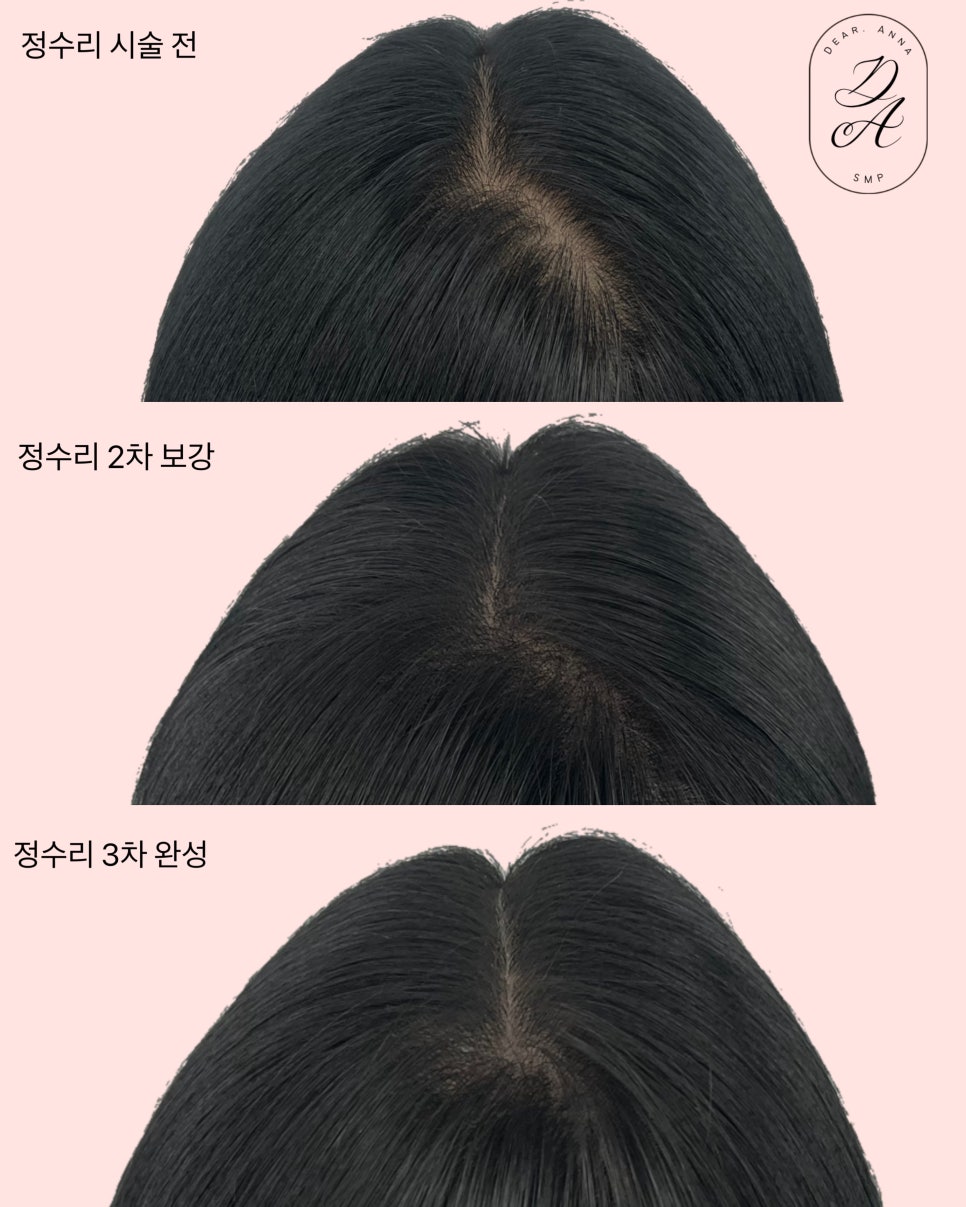 디어니즈 이미지
