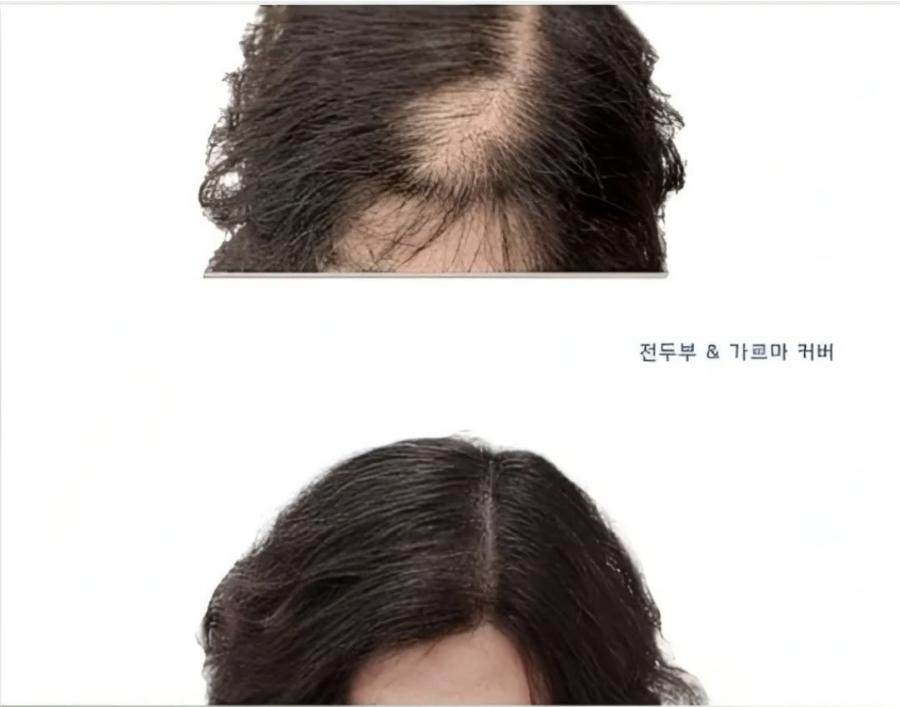 더샤인뷰티 이미지