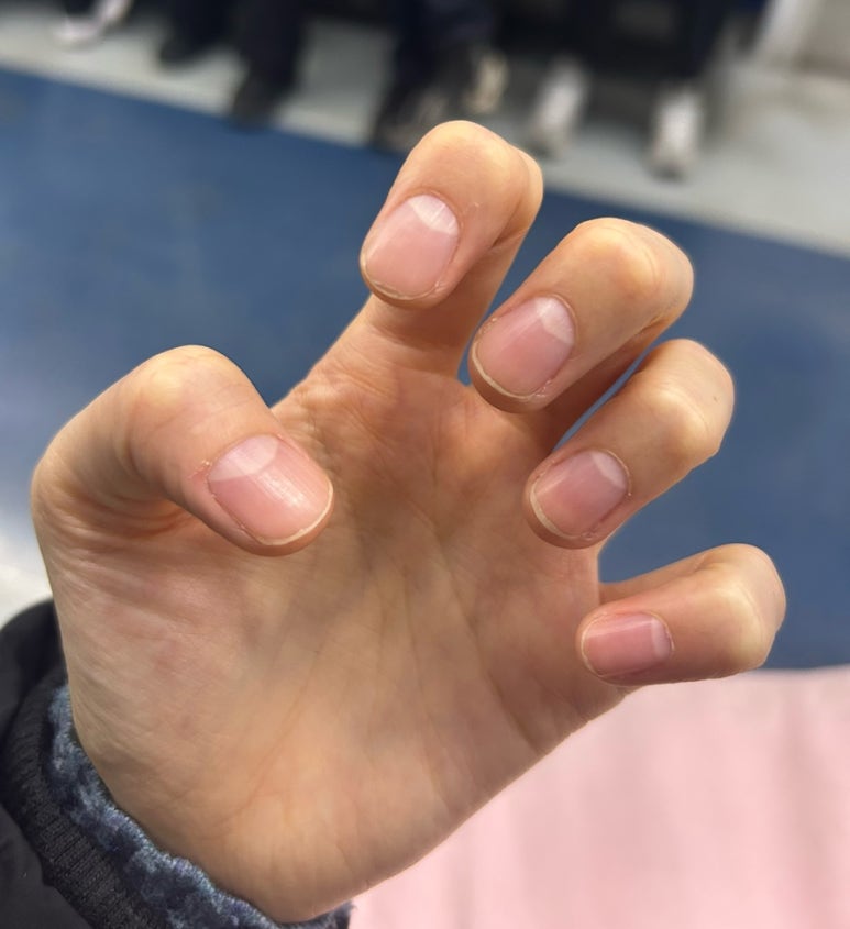 다몽네일 이미지