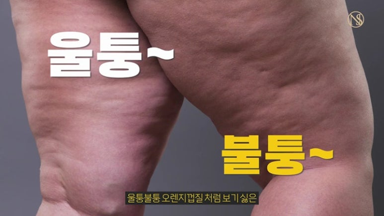 문샵 이미지