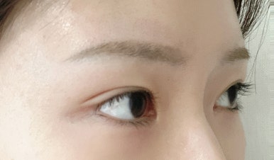 올단 이미지