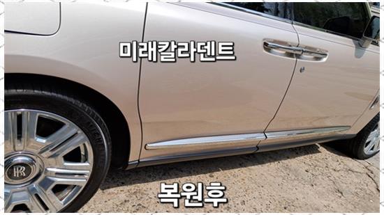 미래덴트칼라 이미지