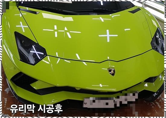 미래덴트칼라 이미지