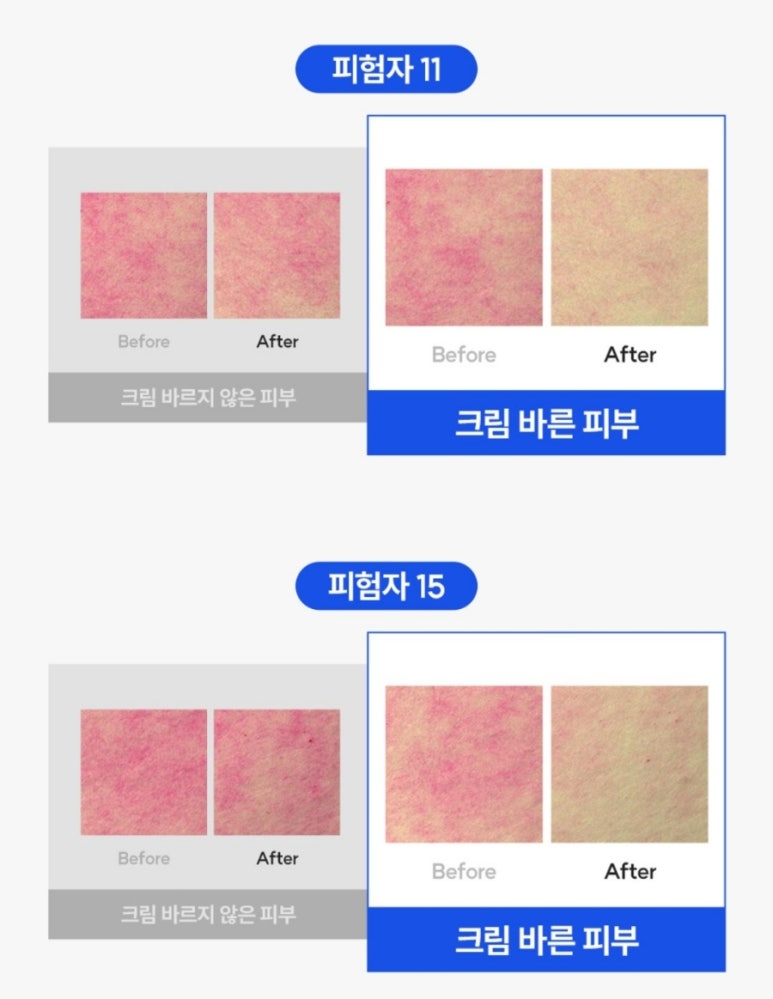 퓨어케이 이미지