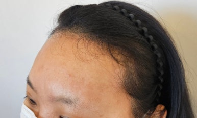 디에이치헤어 이미지