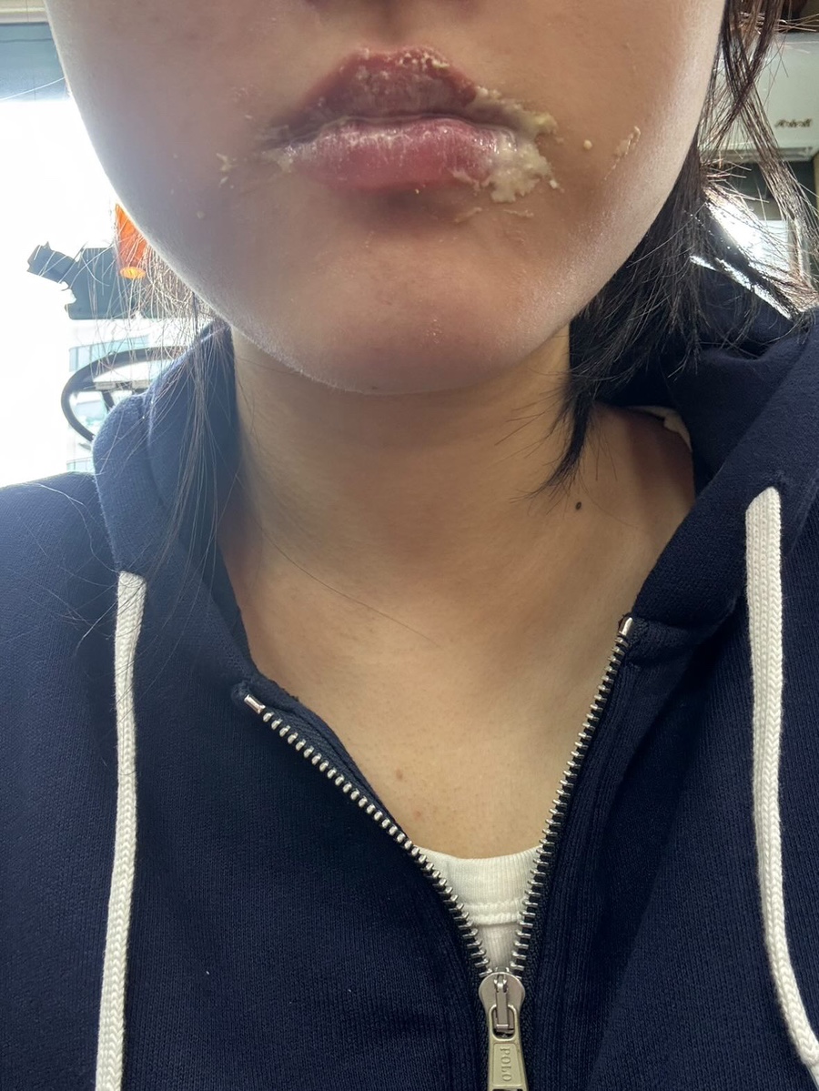 얼큰이 이미지