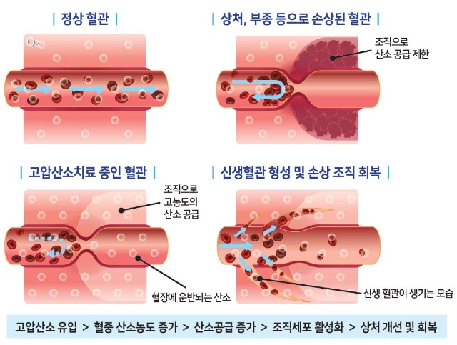산소로 이미지