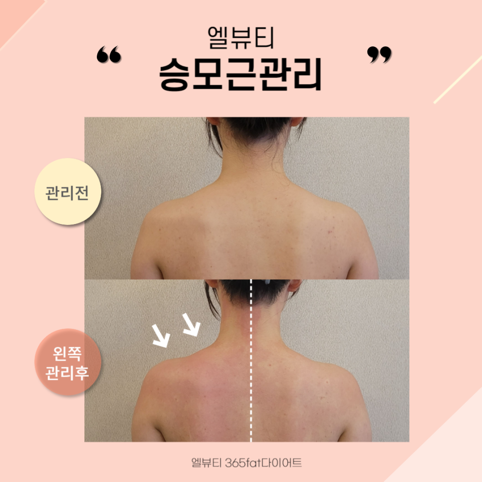 365뷰티라인 이미지