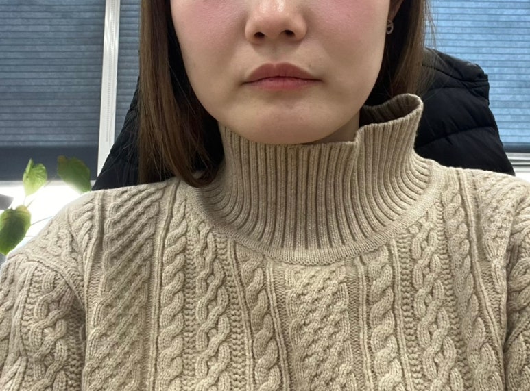 쇼머스트고온 이미지