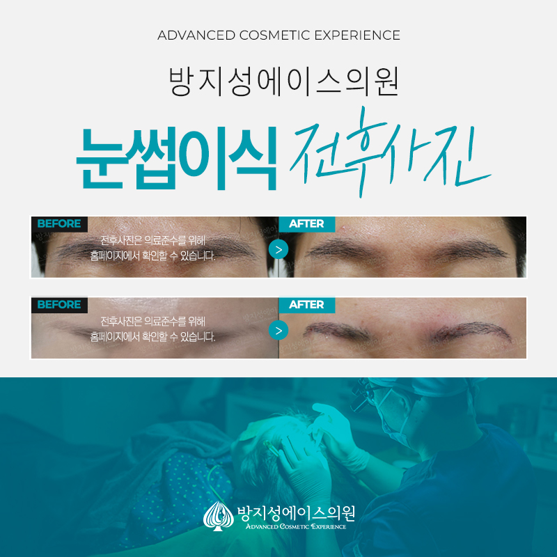 방지성에이스의원 이미지