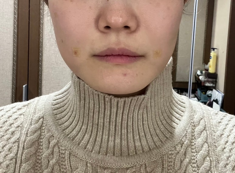 쇼머스트고온 이미지