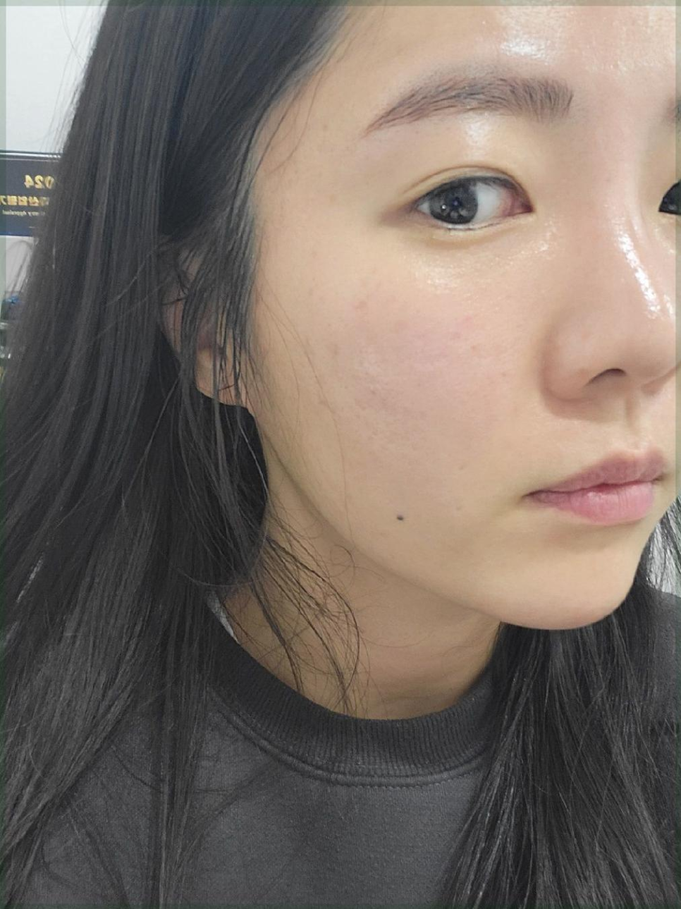 비앤비 에스테틱 이미지
