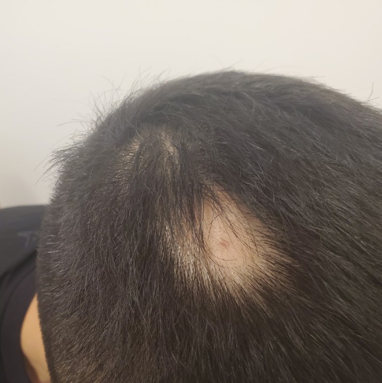 숲칼프가산두피탈모전문센터 이미지