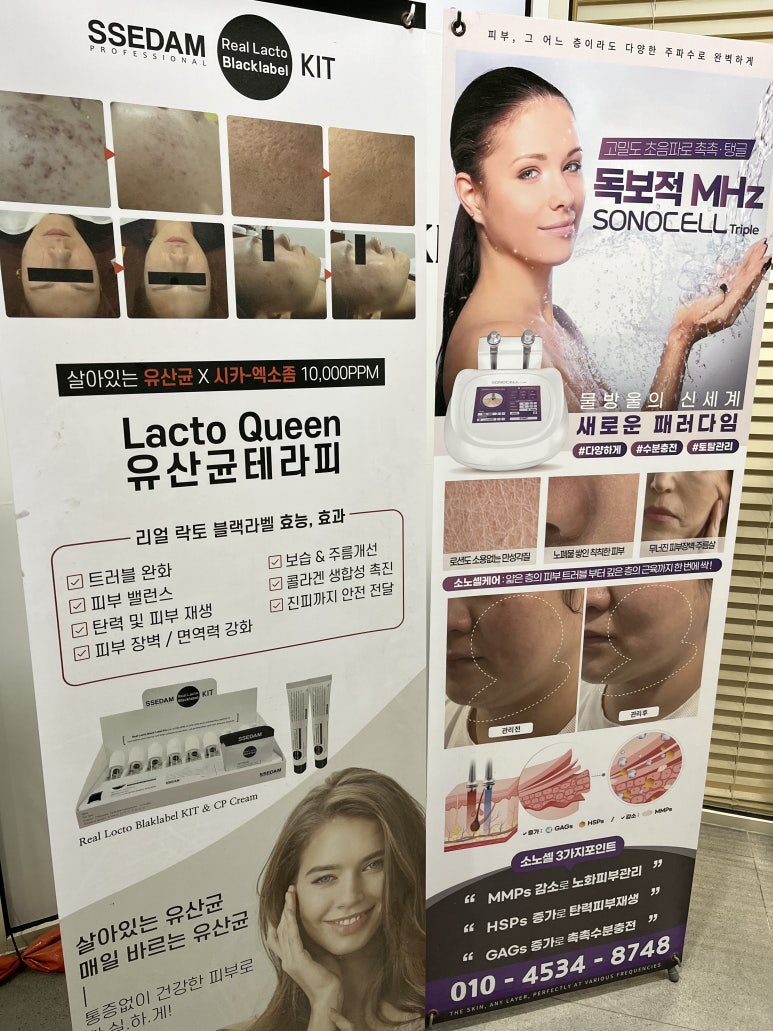 어라운더 스킨 이미지