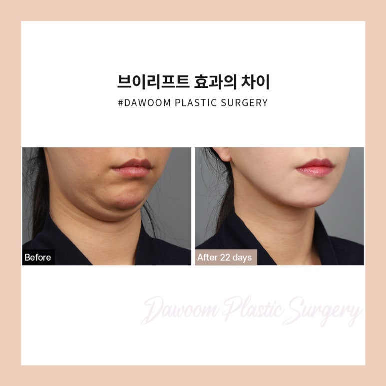 선다움 이미지
