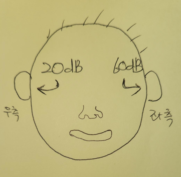 가릴차! 덮을폐! 차폐검사, 뭘 가리고 덮는다는 건지? — 원문 이미지 6