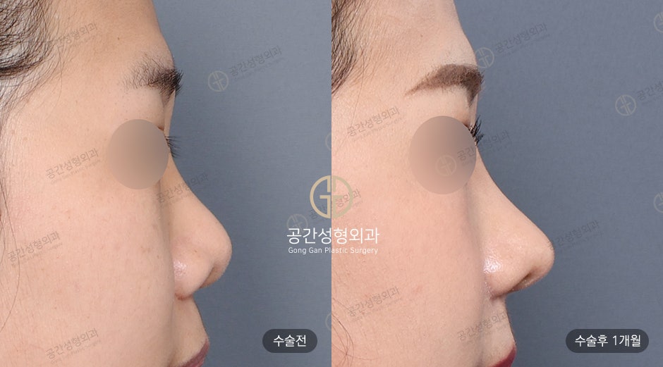 케이스코 이미지
