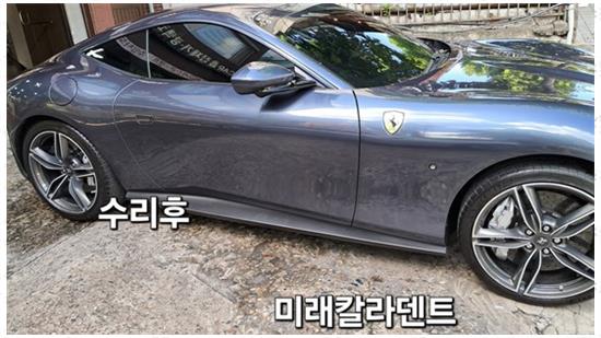 미래덴트칼라 이미지