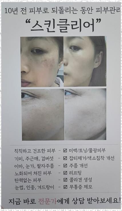 예쁘제 이미지