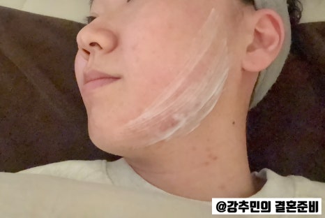 아이섭 이미지