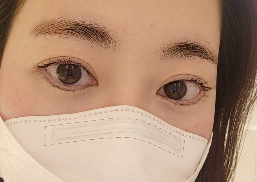 블링진 이미지