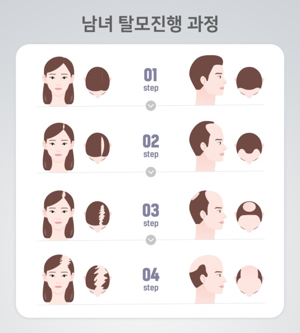 백플러스 이미지