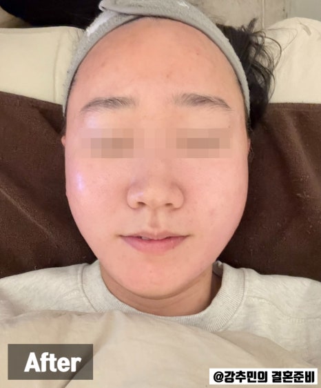 아이섭 이미지