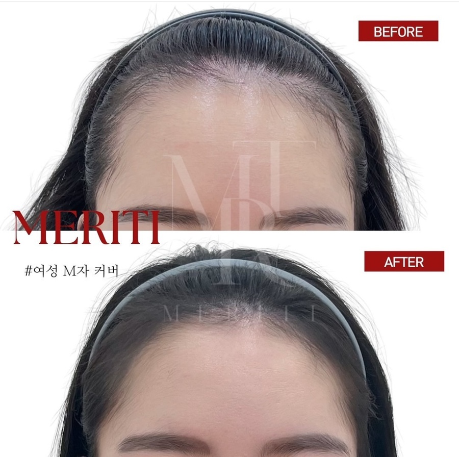 헤어팡팡&가발 이미지