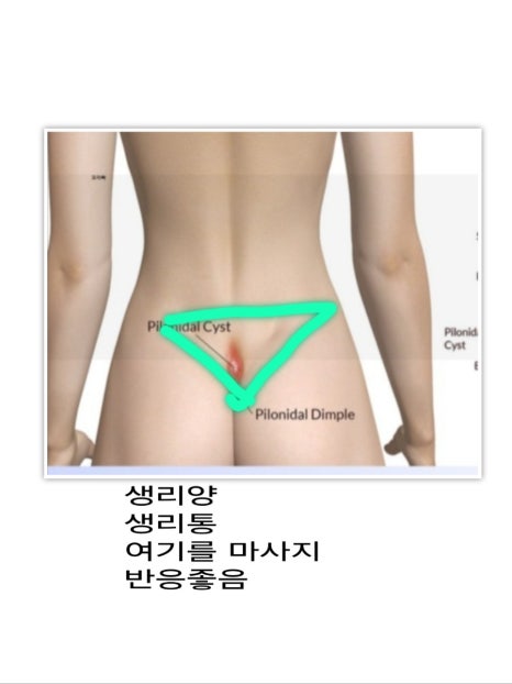 궁테라피 이미지