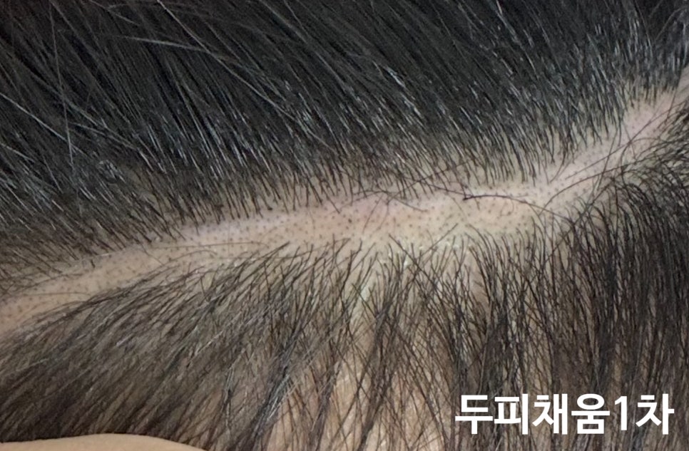 도트바이림 이미지