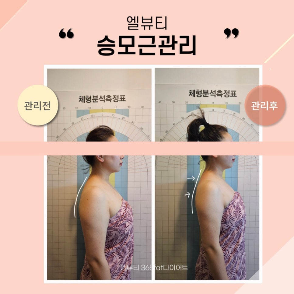 365뷰티라인 이미지