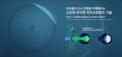 스텔 이미지