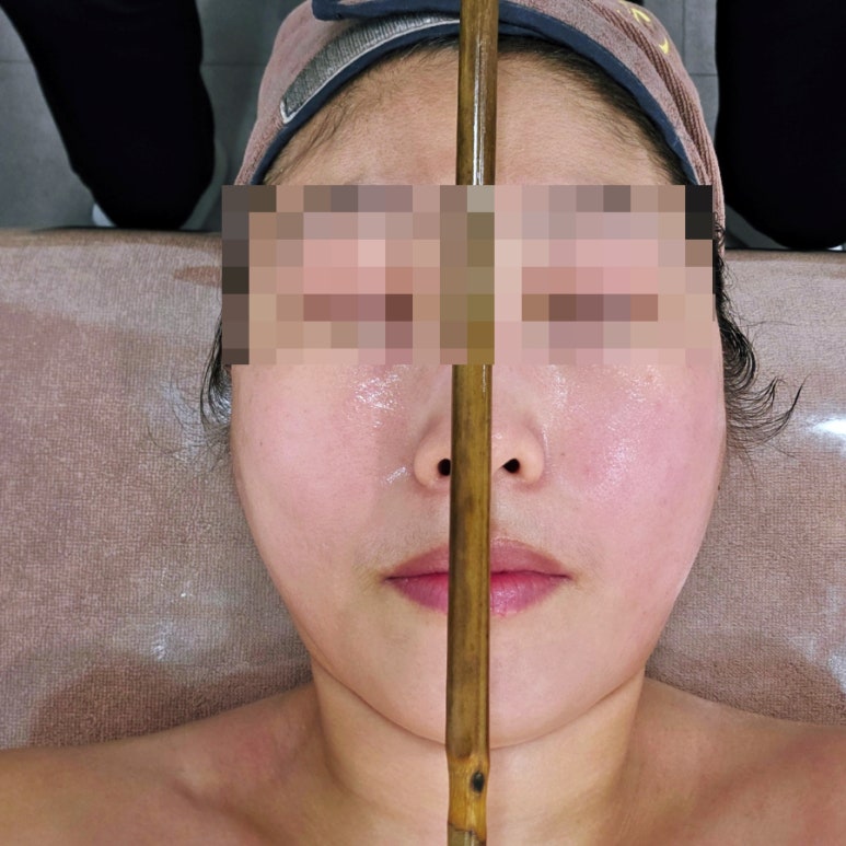 포레스트스킨앤바디 이미지