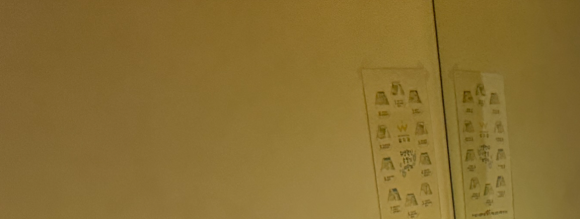 서울윌치과의원 이미지