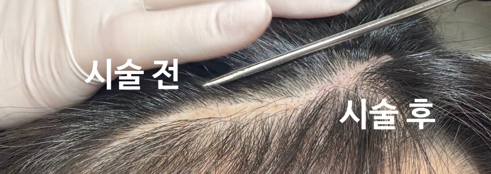도트바이림 이미지