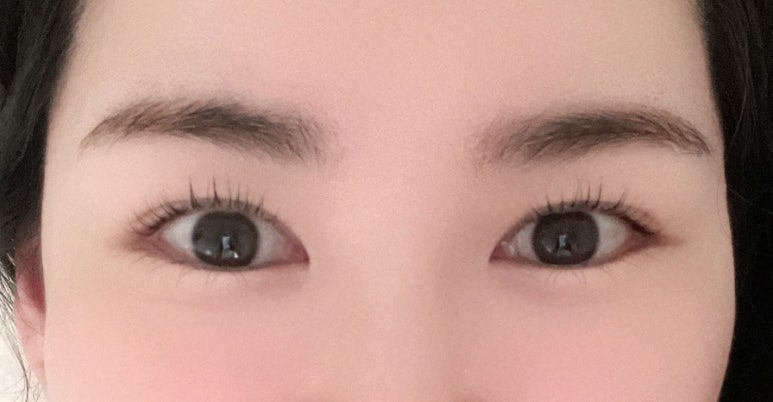 찰리뷰티펌 이미지