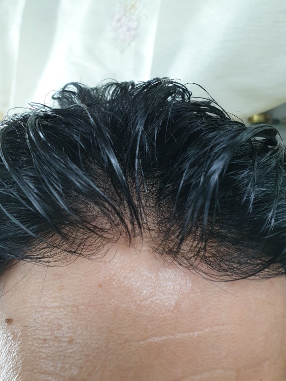 플러스모발센터 이미지