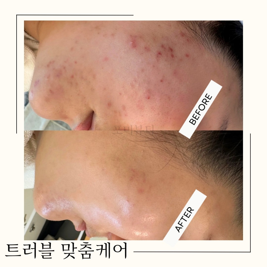 포미 이미지