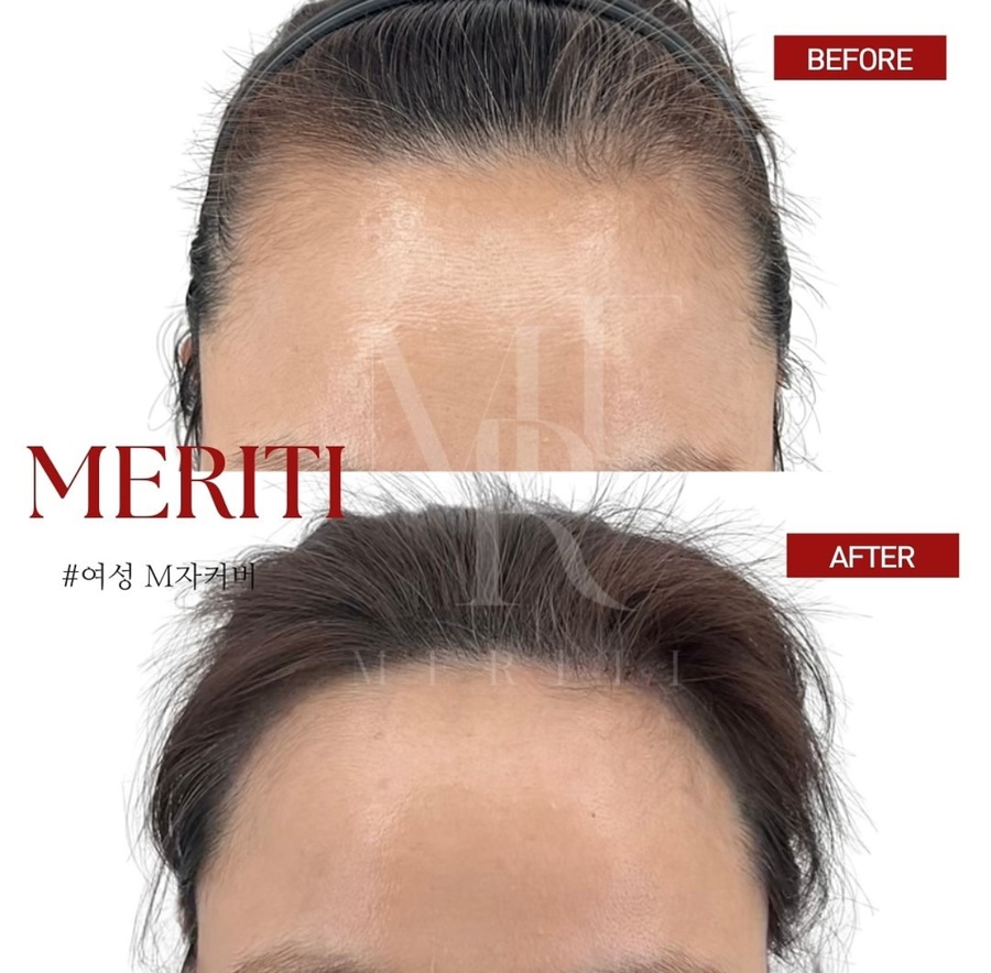 헤어팡팡&가발 이미지