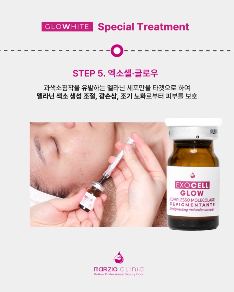 글로우에스테틱 이미지