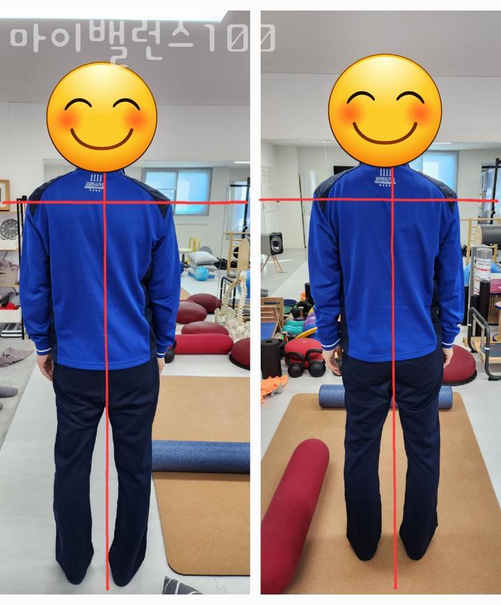 마이밸런스100 이미지
