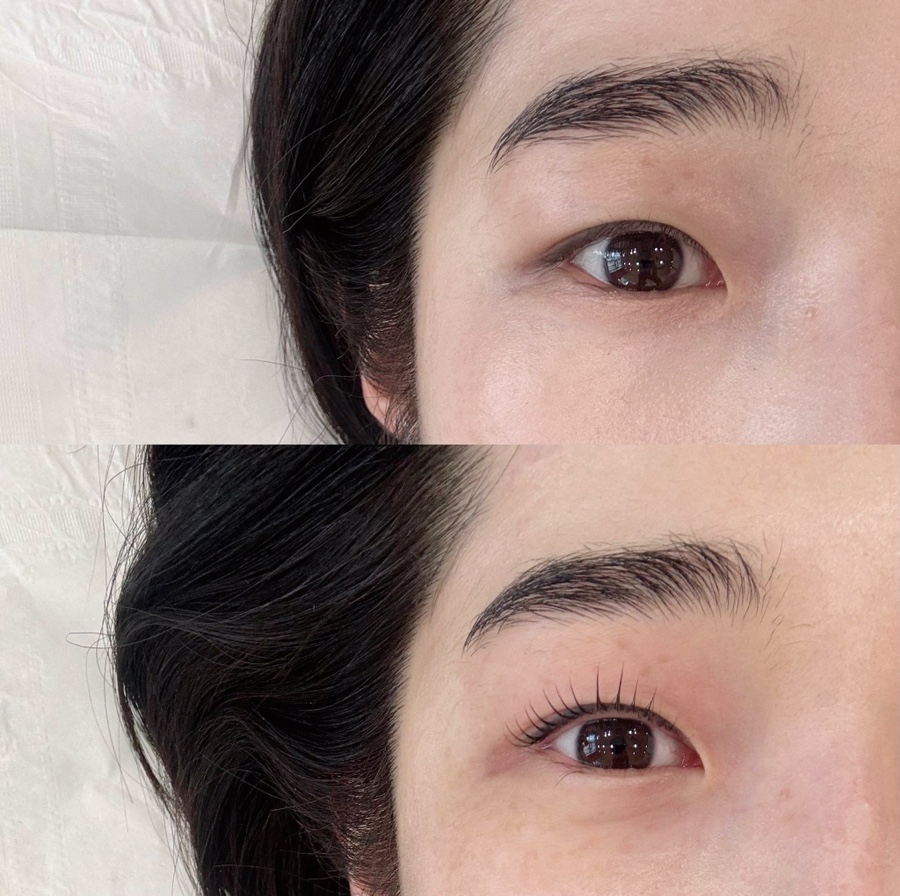 눈숲 이미지