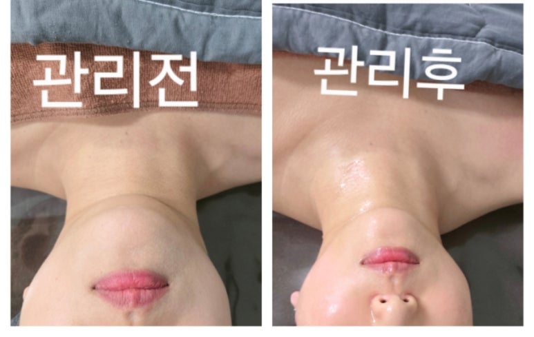 오늘은밝은피부 이미지