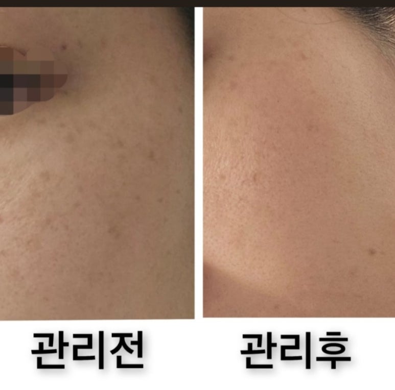 오늘은밝은피부 이미지