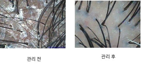 하루두피 동탄역점 이미지