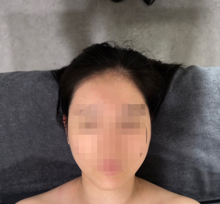 고은피부관리 이미지