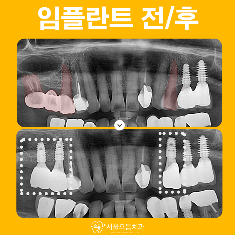 서울으뜸치과의원 이미지
