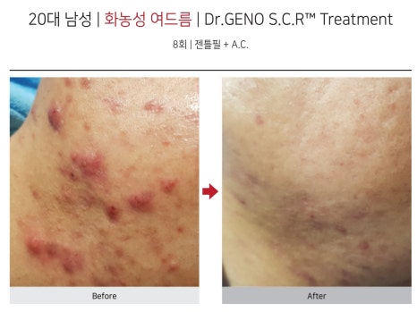 수뷰티&귀족다이어트 이미지